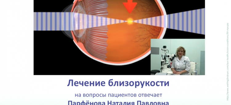 Лечение близорукости у детей Ответы на вопросы пациентов