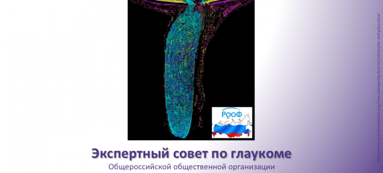 Глаукома Заседание Экспертного совета АВО в Москве