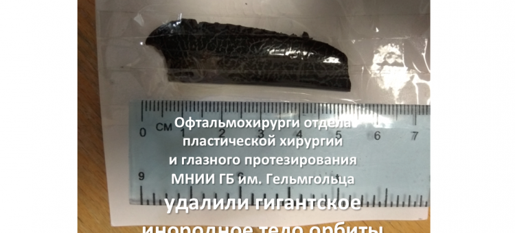 Гигантское инородное тело орбиты Успешная операция