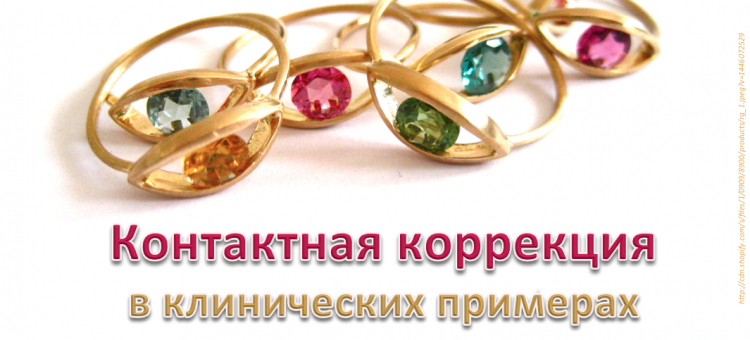 Контактная коррекция в клинических примерах