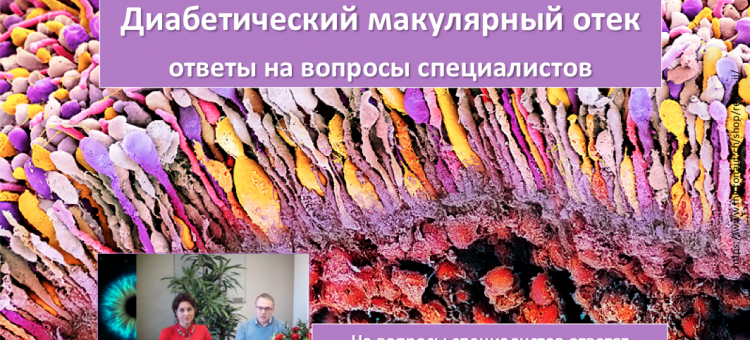 Диабетический макулярный отек Ответы на вопросы