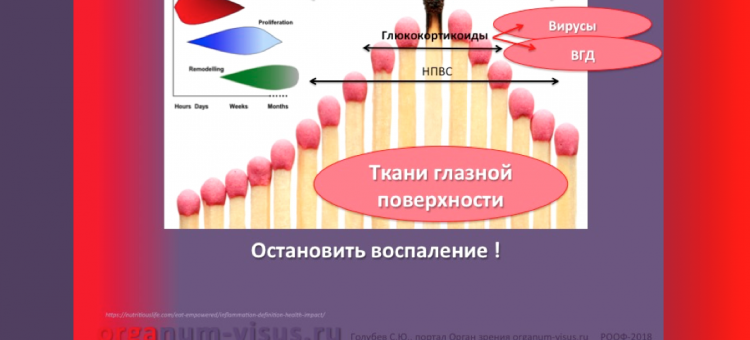 Сухой глаз Лечение воспаления тканей глазной поверхности