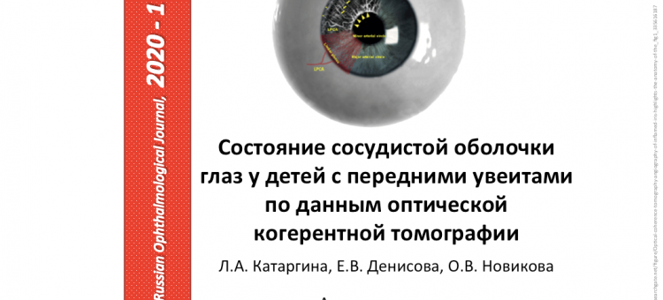 Передний увеит и ОКТ Исследования НМИЦ ГБ им Гельмгольца