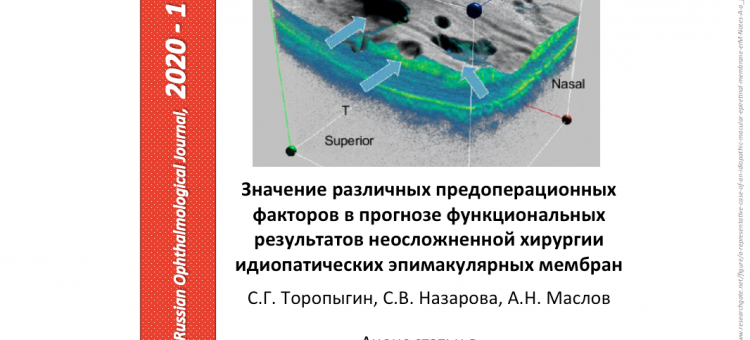 Хирургия эпимакулярных мембран Данные офтальмологов Твери
