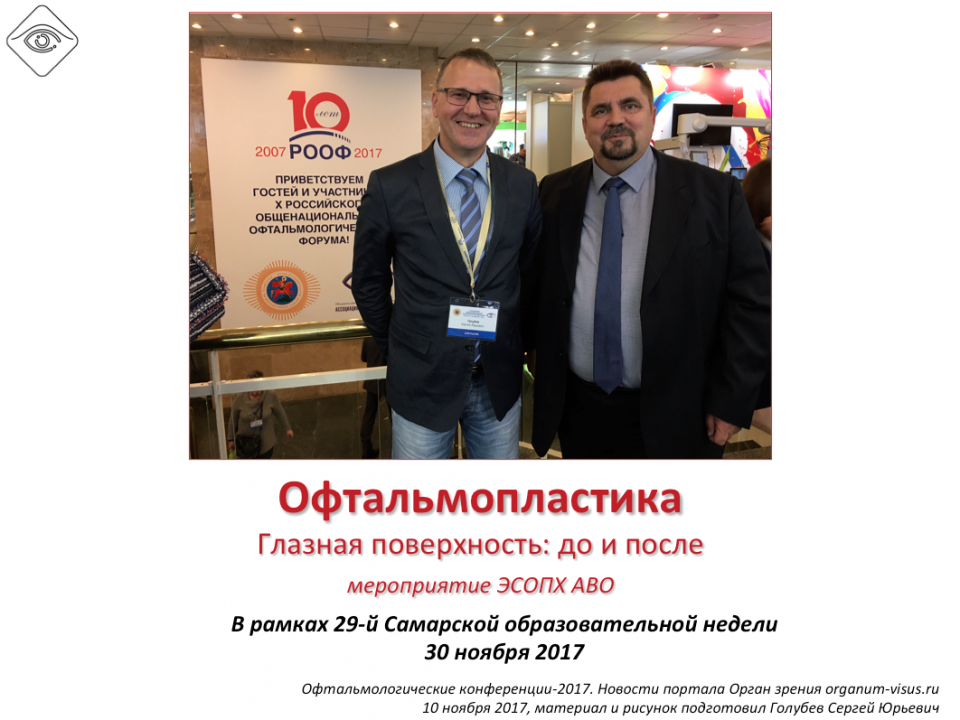 Офтальмопластика в Самаре