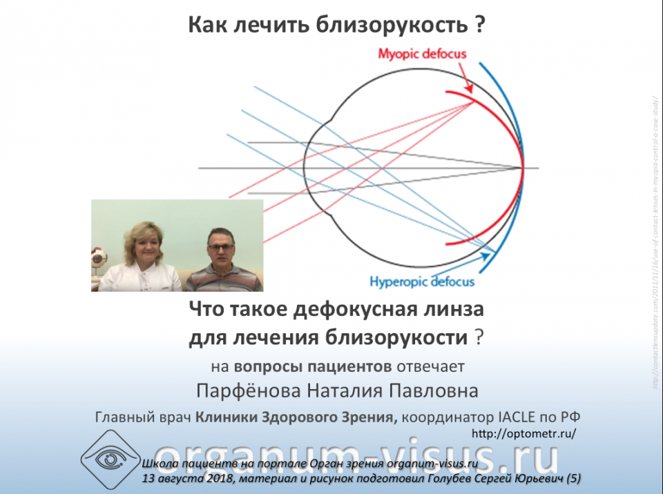 Вопрос пациента Лечение миопии Дефокусные линзы