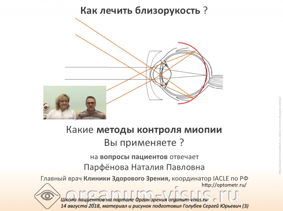 Вопрос пациента Как остановить близорукость