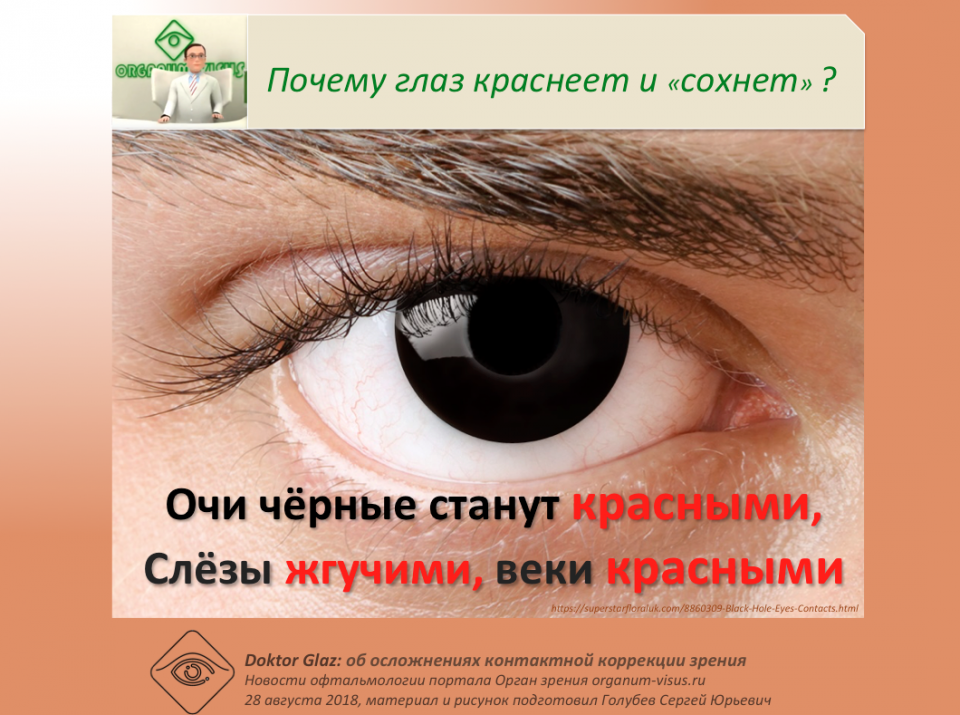 Доктор Глаз Очи черные станут красными Осложнения контактных линз