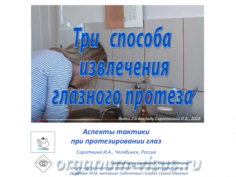 Глазное протезирование Как правильно извлечь протез
