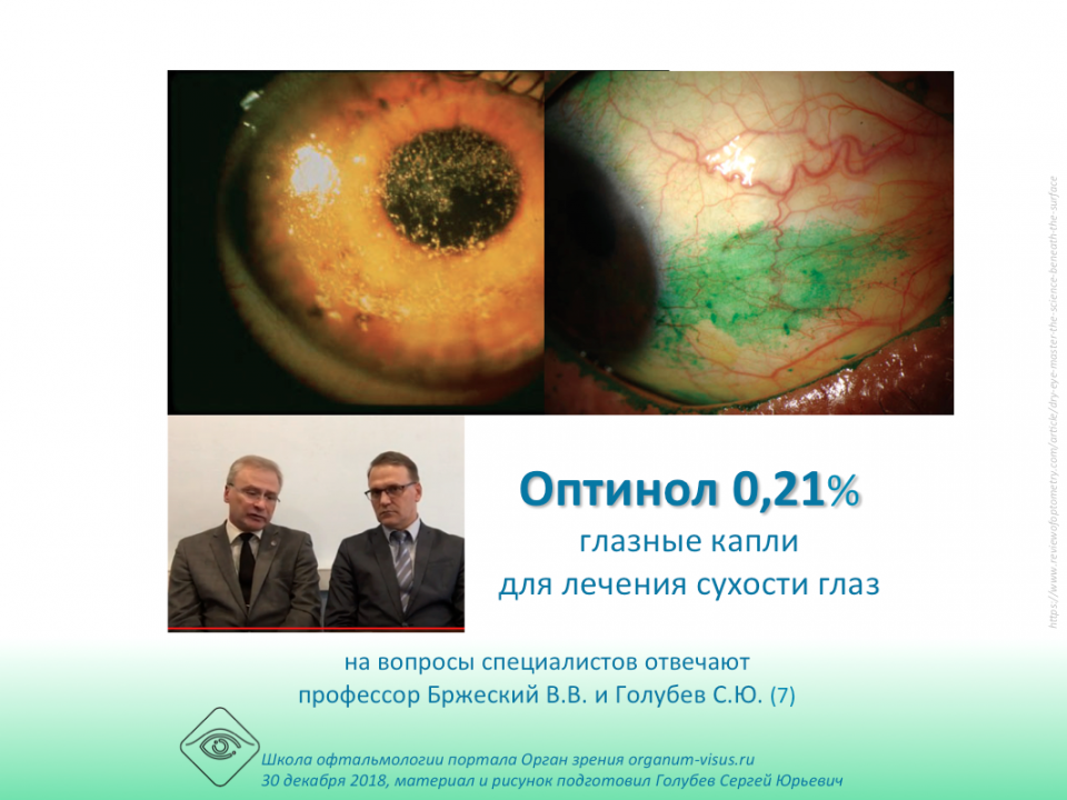 Сухой глаз Лечение Оптинол 0,21%