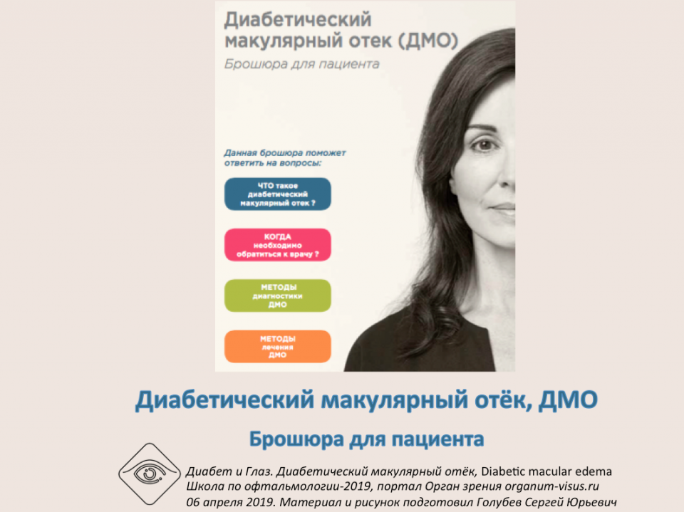 Диабетический макулярный отёк Ответы на вопросы