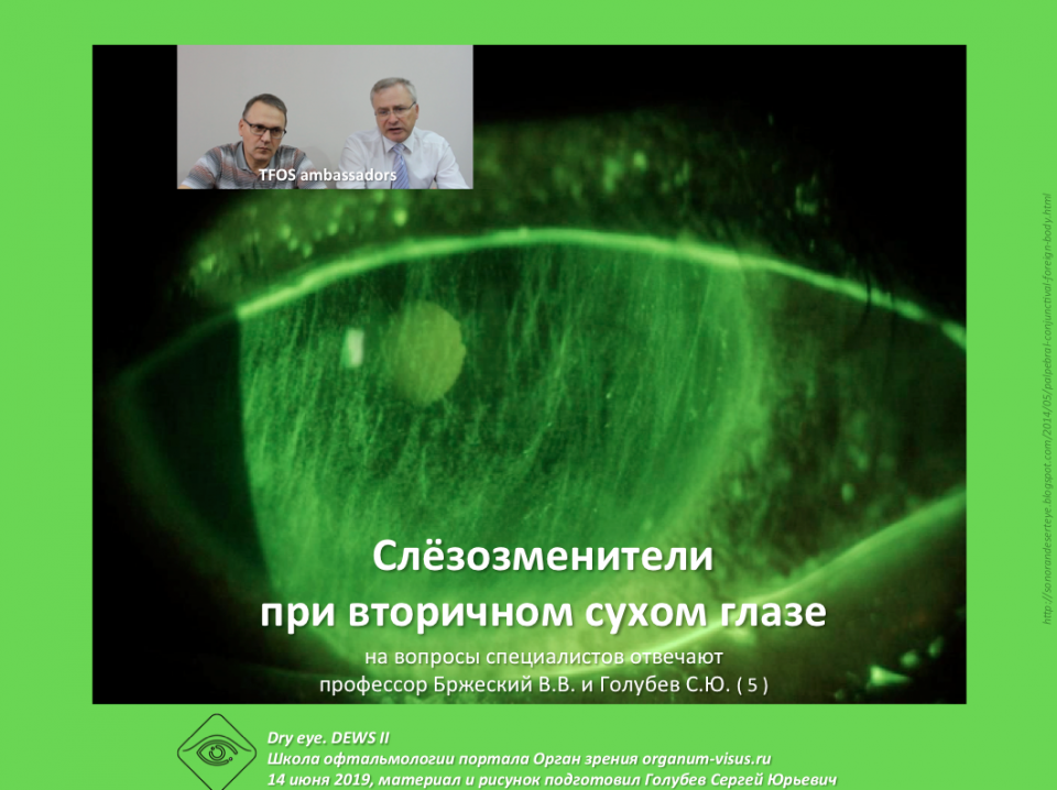 Сухой глаз Причины сухости глазной поверхности