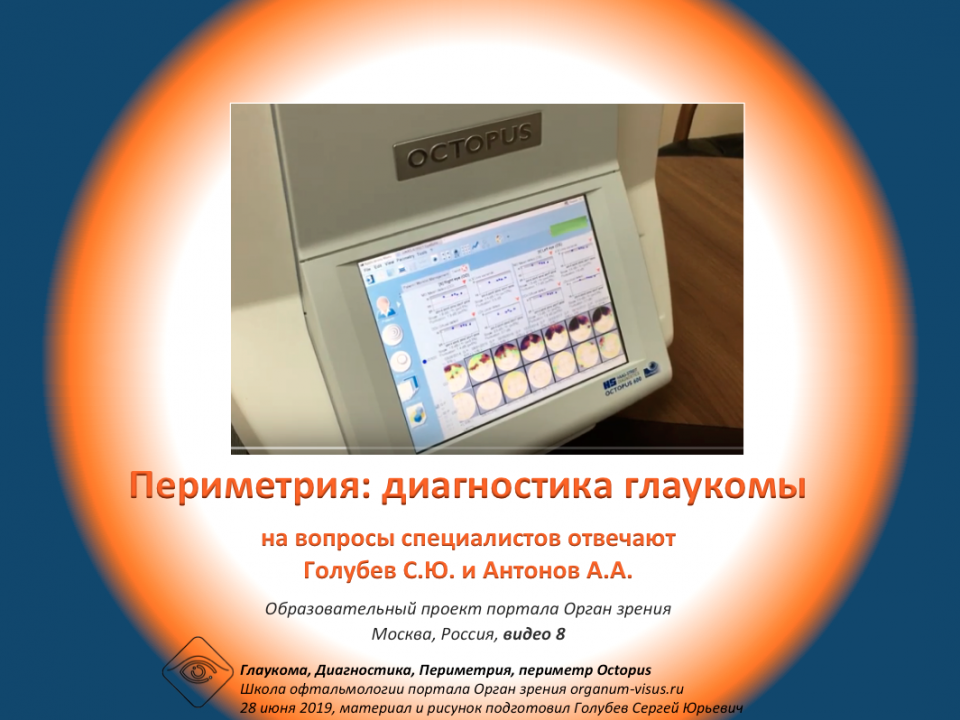 Диагностика глаукомы Периметрия Условия Видео