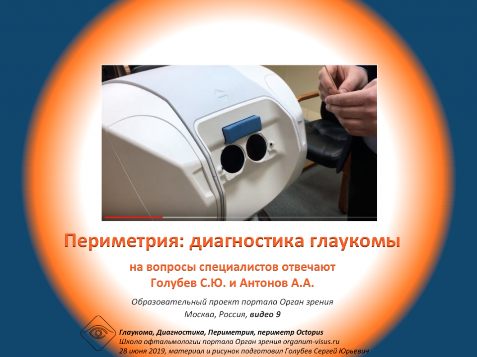 Диагностика глаукомы Периметрия Видео