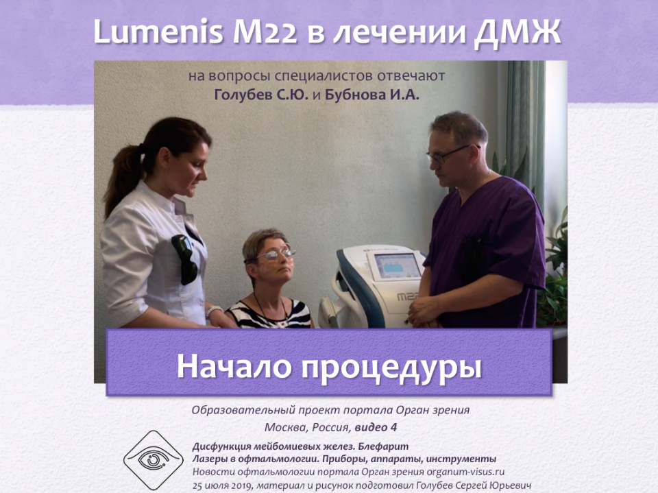 Лечение блефаритов и ДМЖ Lumenis M22 Видео 4