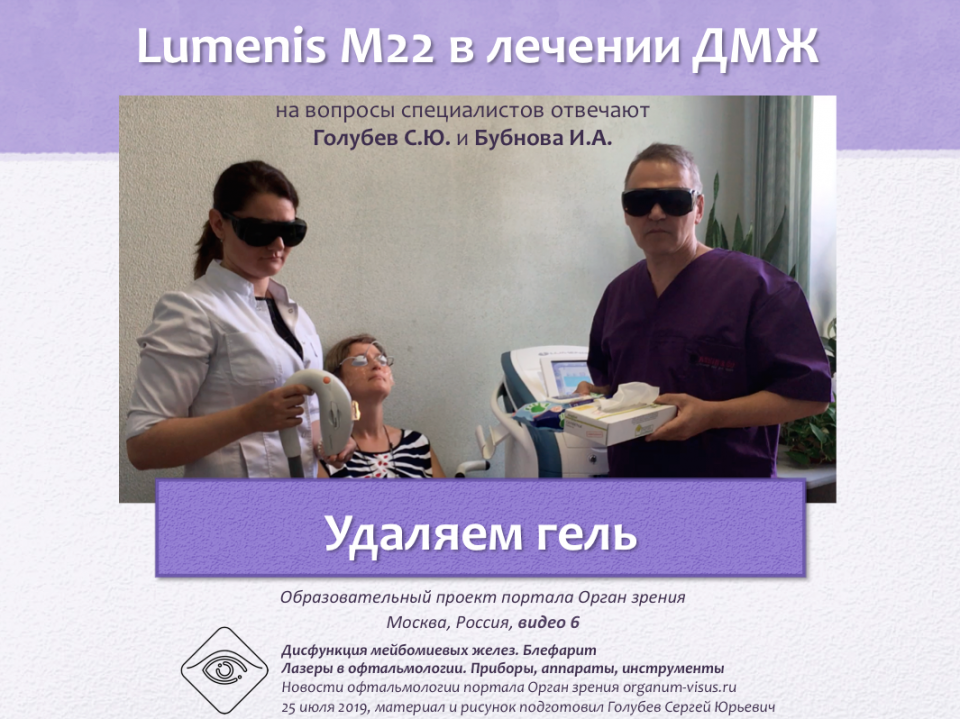 Лечение блефаритов и ДМЖ Lumenis M22 Видео 6