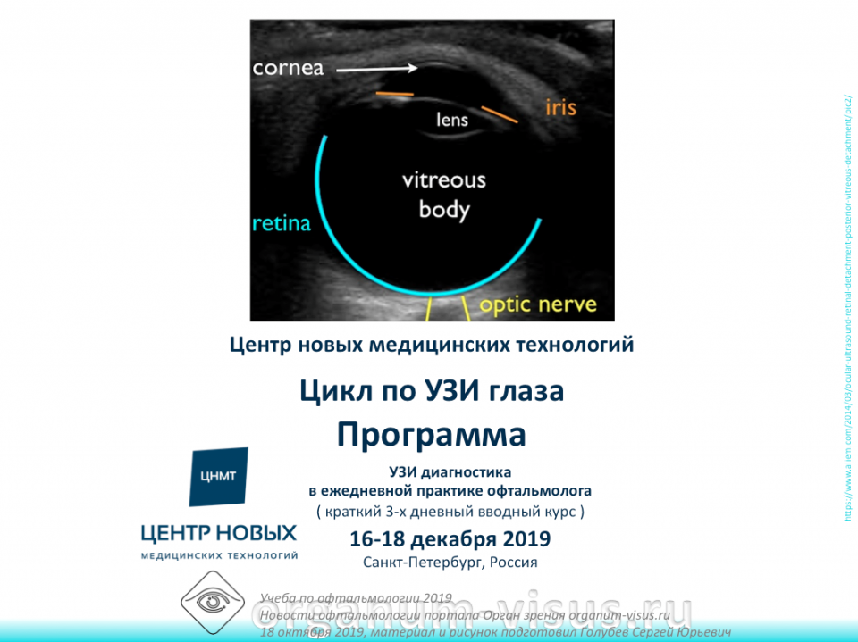 Учеба по офтальмологии УЗИ глаза ЦНМТ СПб
