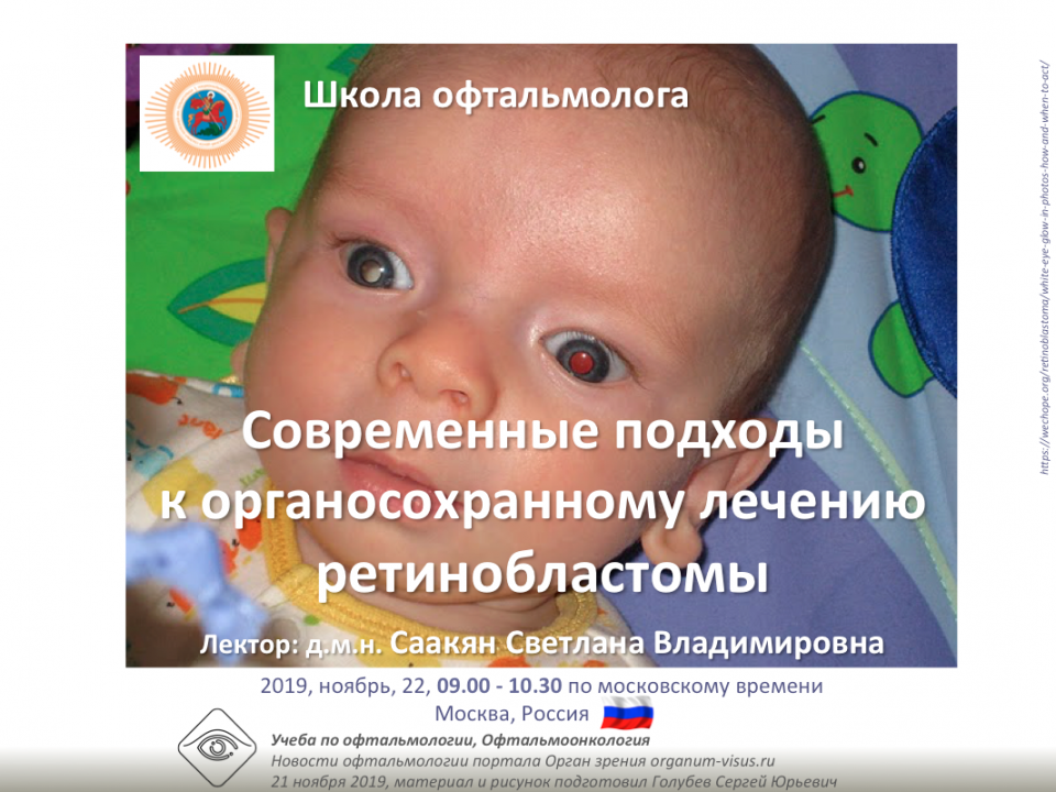Телемедицина в офтальмологии НМИЦ ГБ им Гельмгольца Ретинобластома