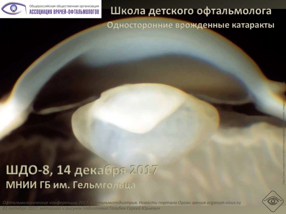 Школа детского офтальмолога