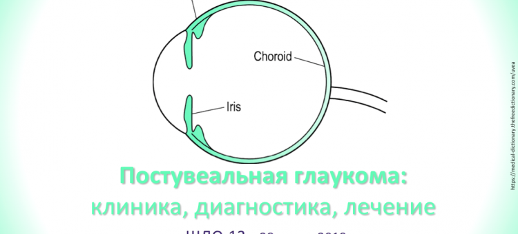 Школа детского офтальмолога ШДО 13 Москва Россия