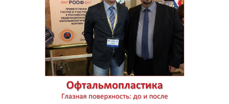 Офтальмопластика в Самаре