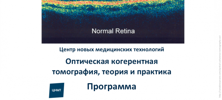 Учеба по офтальмологии ОКТ ЦНМТ СПб