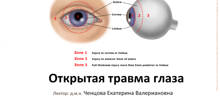 Телемедицина в офтальмологии НМИЦ ГБ им Гельмгольца Травма глаза