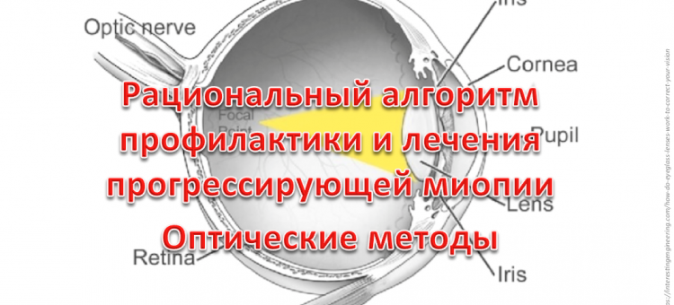 Телемедицина в офтальмологии НМИЦ ГБ им Гельмгольца Миопия