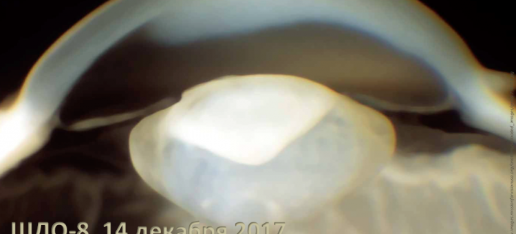 Школа детского офтальмолога