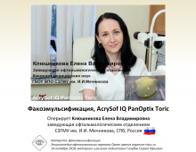 Катаракта AcrySof IQ PanOptix Toric